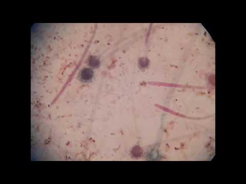 FUNGAL HYPHAE & MYCELIA