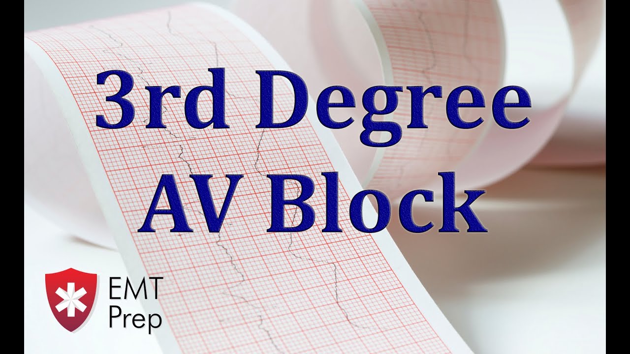 3rd Degree AV Block ECG - EMTprep.com
