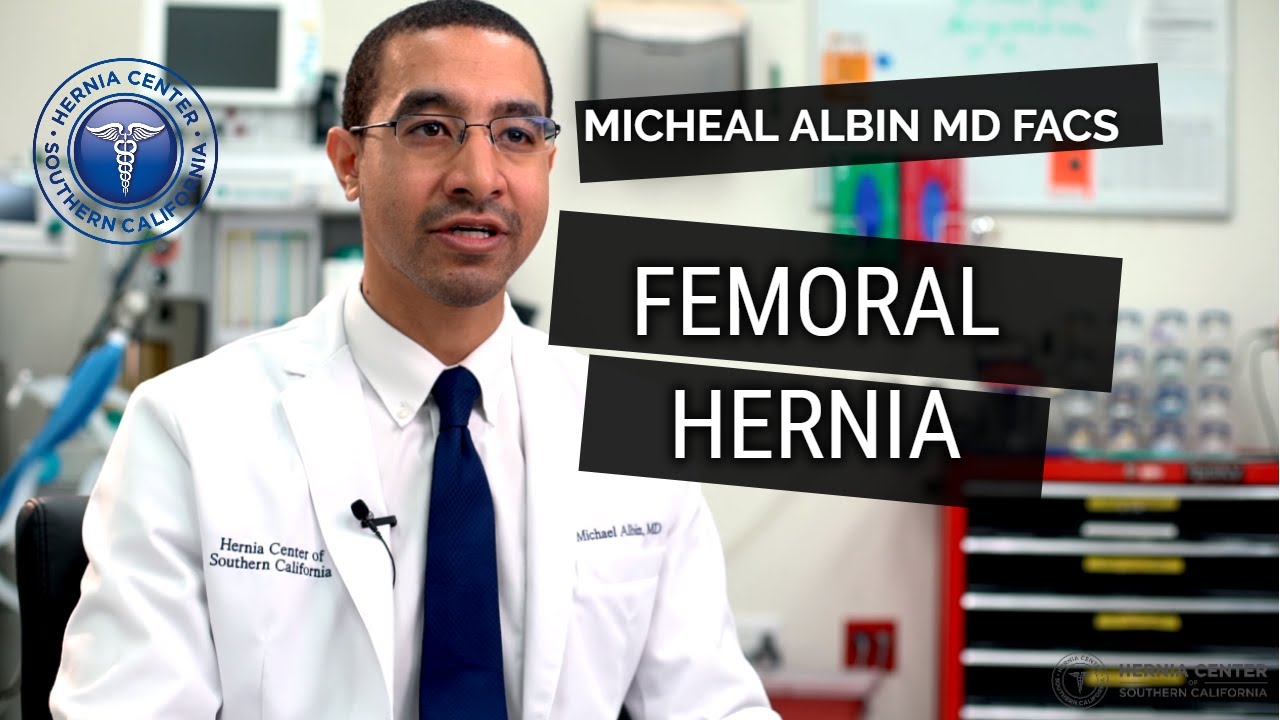 Femoral Hernia: Causes, Symptoms, Diagnosis & Treatment. Explained by Michael Albin, M.D. F.A.C.S