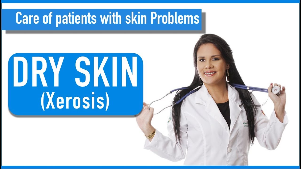 Nursing Essentials - Xerosis (Dry Skin)
