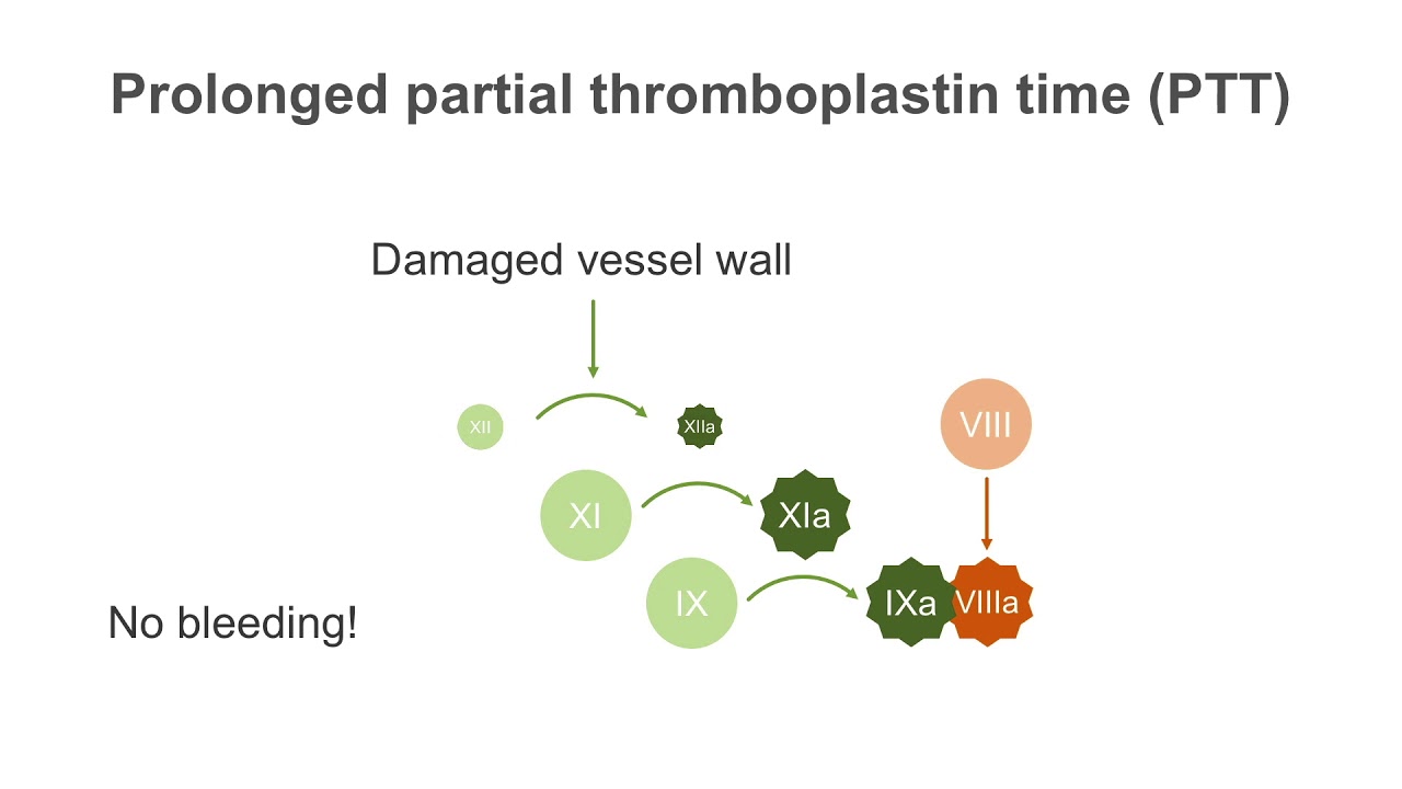 How to interpret a partial thromboplastin time (PTT) test