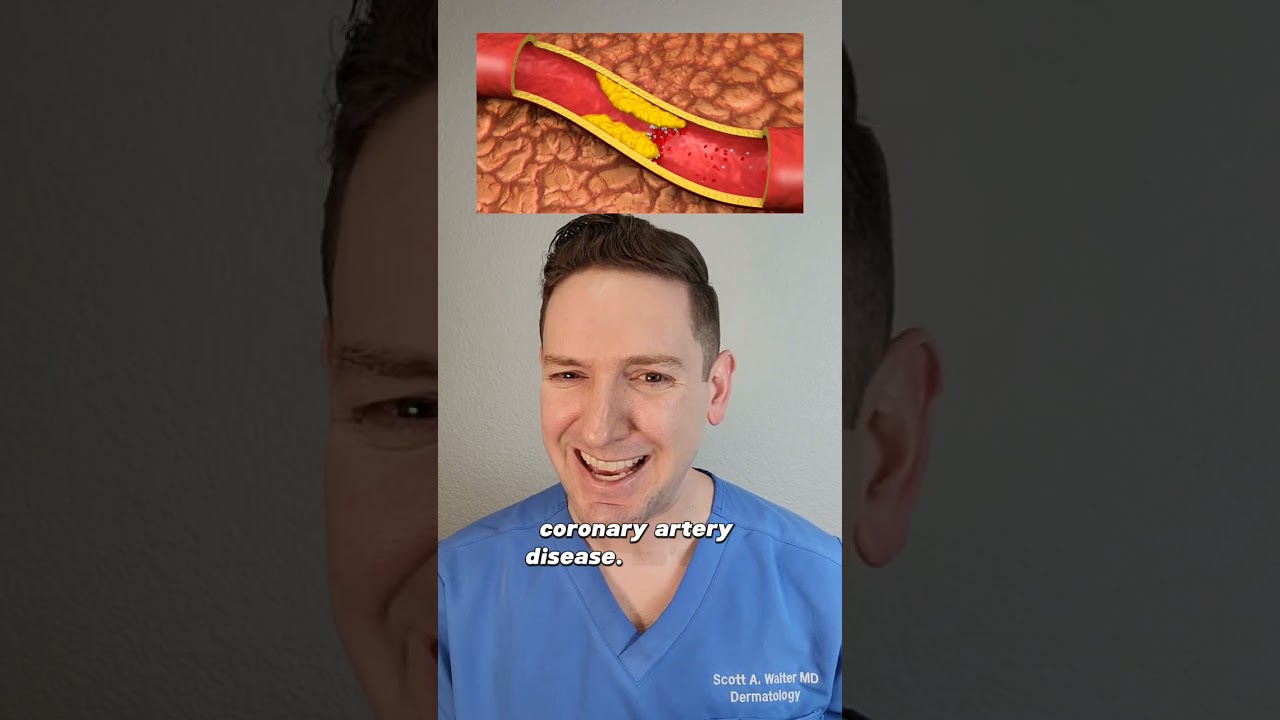 Frank's Sign: Doctor explains how your earlobe can tell you about your health! #health #earlobe
