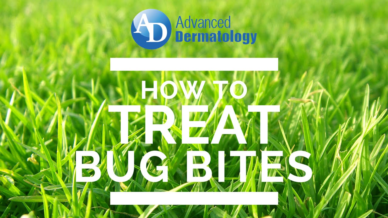 How to Treat Gnat Bites