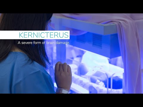 Kernicterus and Jaundice In New Borns