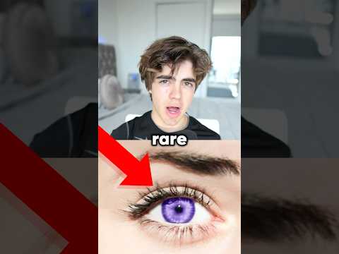 How rare is your eye color? 😱