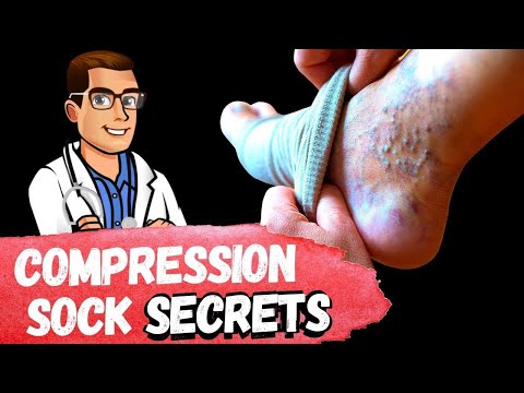 BEST Compression Socks TIPS [How To Fix Swollen Feet, Ankles & Legs]