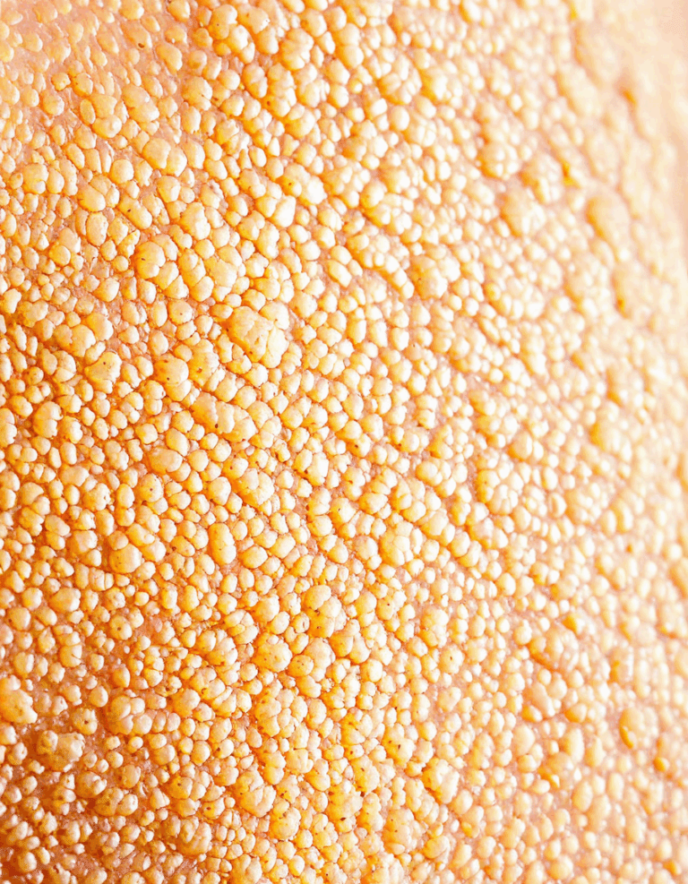 how to identify scabies