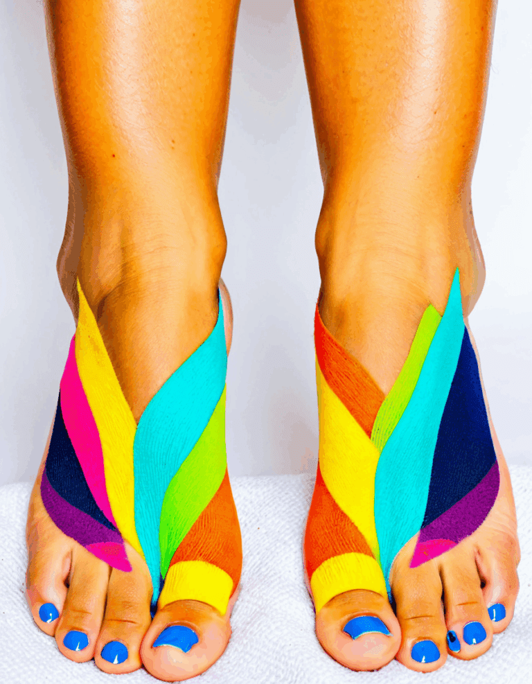 tinea pedis symptoms